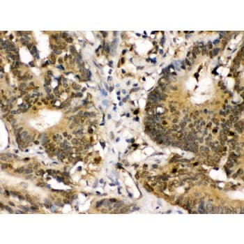 Polyclonal Rabbit anti-Human MAP2K3 / MEK3 / MKK3 Antibody (aa311-347, IHC, WB)