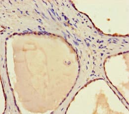 Polyclonal Rabbit anti-Human STAMBP / AMSH Antibody (WB)