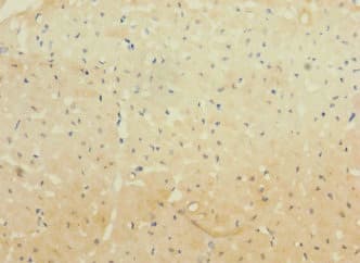WBSCR17 Antibody
