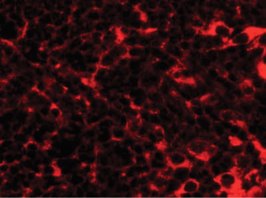 IHC-plus™ Polyclonal Rabbit anti-Human TMEM38B Antibody (IHC, IF, WB)