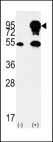 BRAF / B-Raf Antibody (aa424-453)