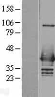 Human HNRNPC / HNRNP C Protein (Over-Expression Lysate Myc-DDK (Flag))