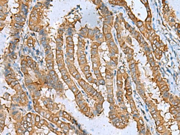 Polyclonal Rabbit anti-Human DPYSL3 / CRMP4 Antibody (IHC)