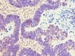 ATP5B / ATP Synthase Beta Antibody (aa230-529)