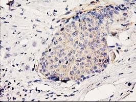 BCAR1 / p130Cas Antibody (clone OTI1B1)