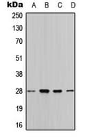 YWHAQ / 14-3-3 Theta Antibody (Internal)