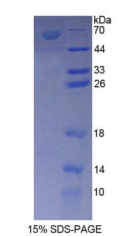 Rat CARP / ANKRD1 Protein (Recombinant His-GST)