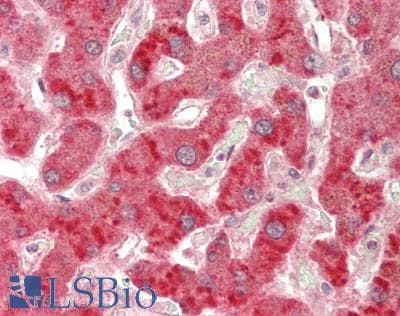 IHC-plus™ Polyclonal Rabbit anti-Human LIPC / Hepatic Lipase Antibody (Internal, IHC, WB)