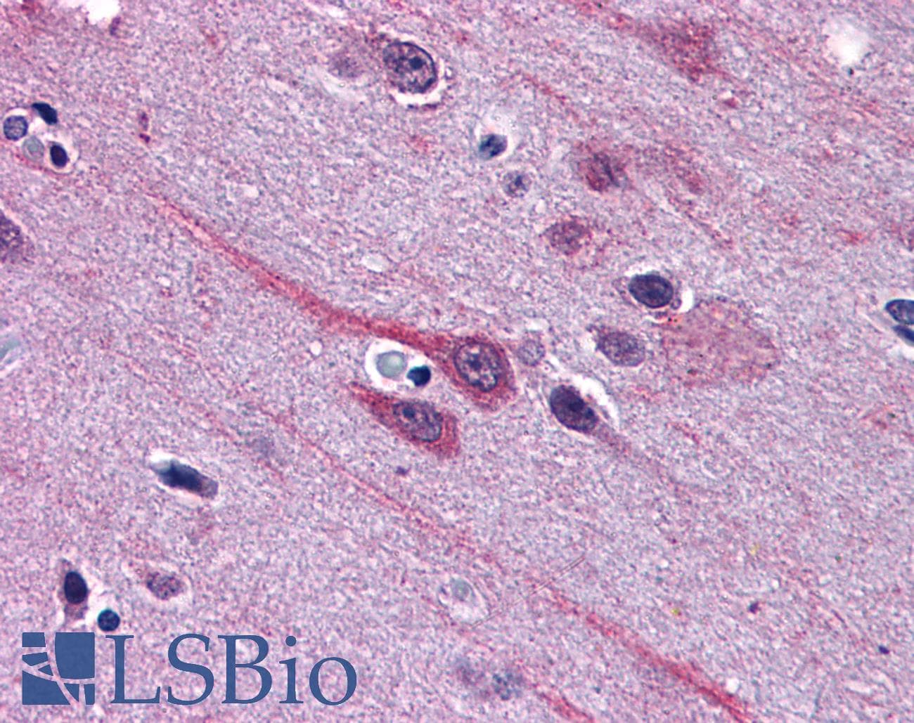 IHC-plus™ GBX2 Antibody (aa181-193)