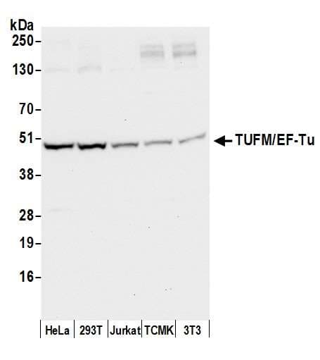 EFTU / TUFM Antibody (aa100-150)