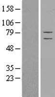 CSRP2BP Protein (Over-Expression Lysate Myc-DDK (Flag))
