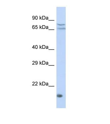 ZNF195 Antibody (aa21-70)