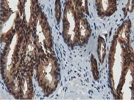 ACAT2 Antibody (clone OTI7B1)