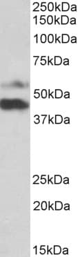 IHC-plus™ FLJ22028 Antibody (aa24-37)