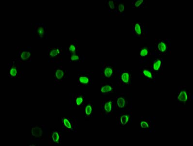 Polyclonal Rabbit anti-Human HIST1H3A Antibody (IHC, IF, WB)