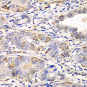 Polyclonal Rabbit anti-Human GCLM Antibody (IHC, WB)