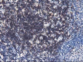 UNG / Uracil DNA Glycosylase Antibody (clone OTI2F8)