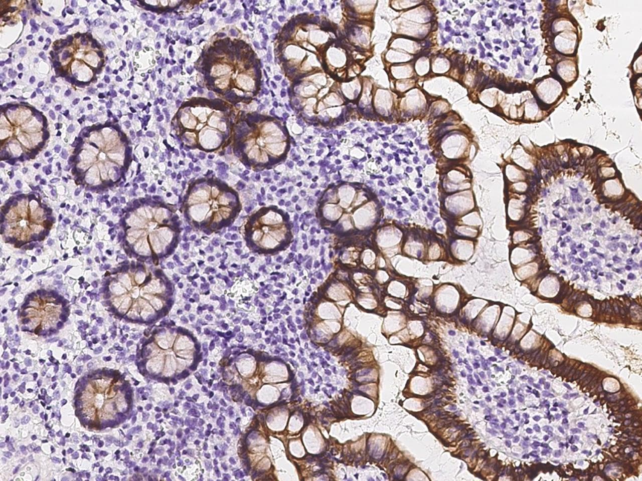 KRT20 / CK20 / Cytokeratin 20 Antibody
