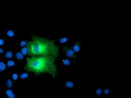 PFKP Antibody (clone OTI1D6)