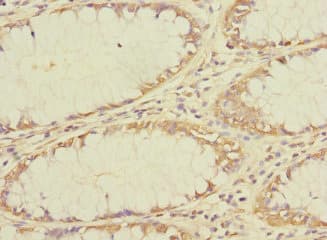 TMEM209 Antibody