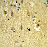 SH3BGRL3 Antibody (aa24-52)