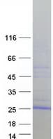 Human VMO1 Protein (Recombinant Myc-DDK (Flag))