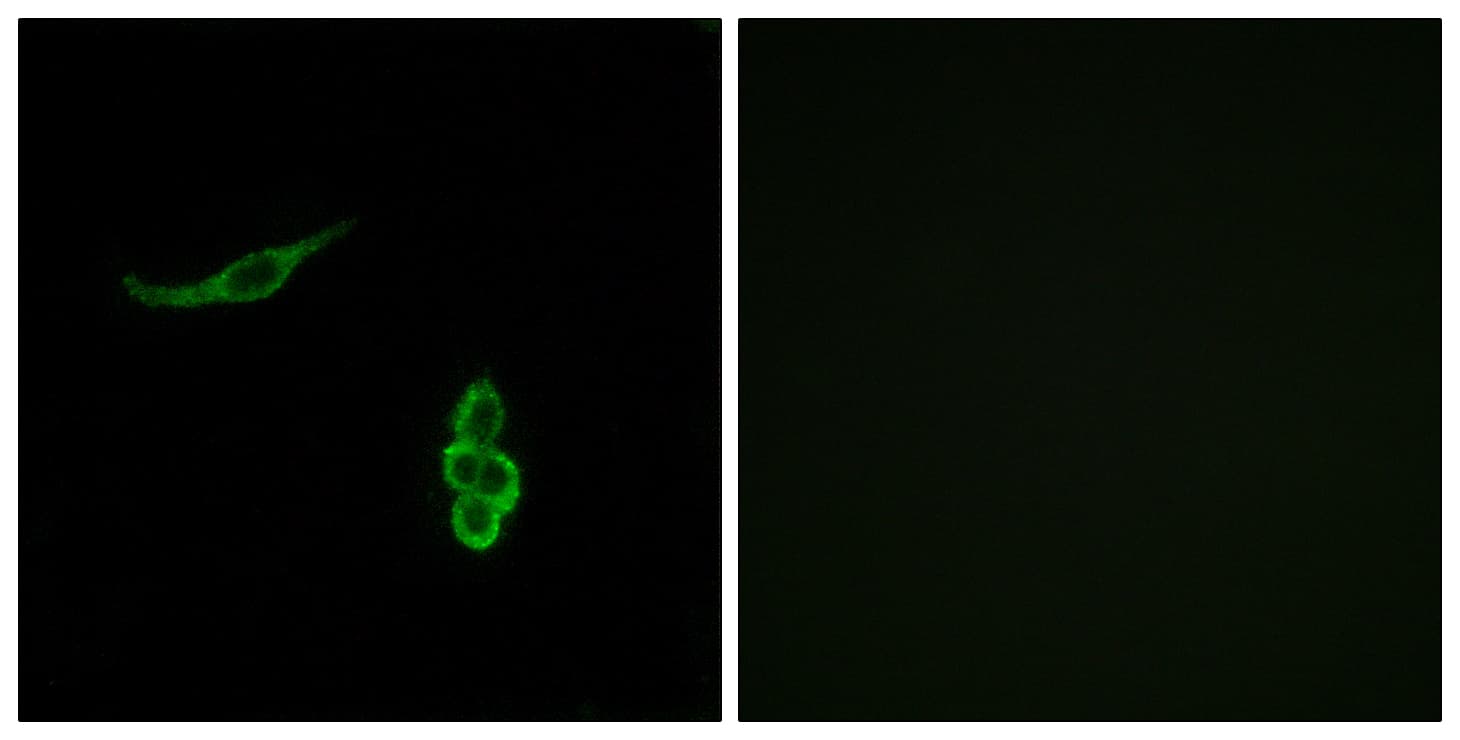 Polyclonal Rabbit anti-Human SCNN1D Antibody (aa411-460, IF, WB)