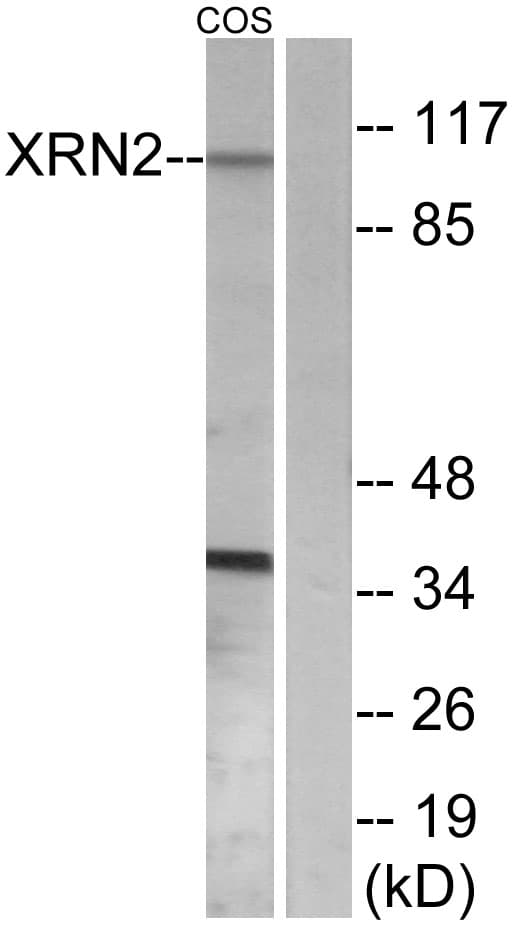 Polyclonal Rabbit anti-Human XRN2 Antibody (aa81-130, IHC, WB)