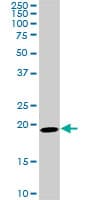 SRI / Sorcin Antibody (clone 1E12)