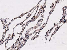 NUDT6 Antibody (clone OTI9D12)