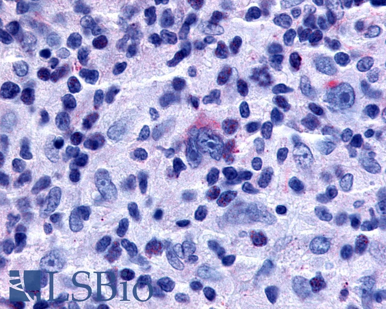 IHC-plus™ GPR65 / TDAG8 Antibody (Cytoplasmic Domain)