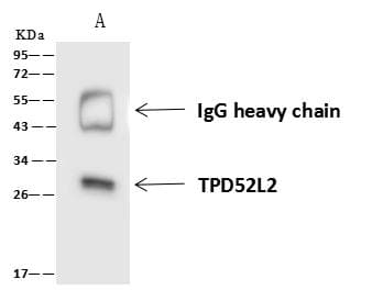 Polyclonal Rabbit anti-Human TPD52L2 / HD54 Antibody (IHC, IF, WB)