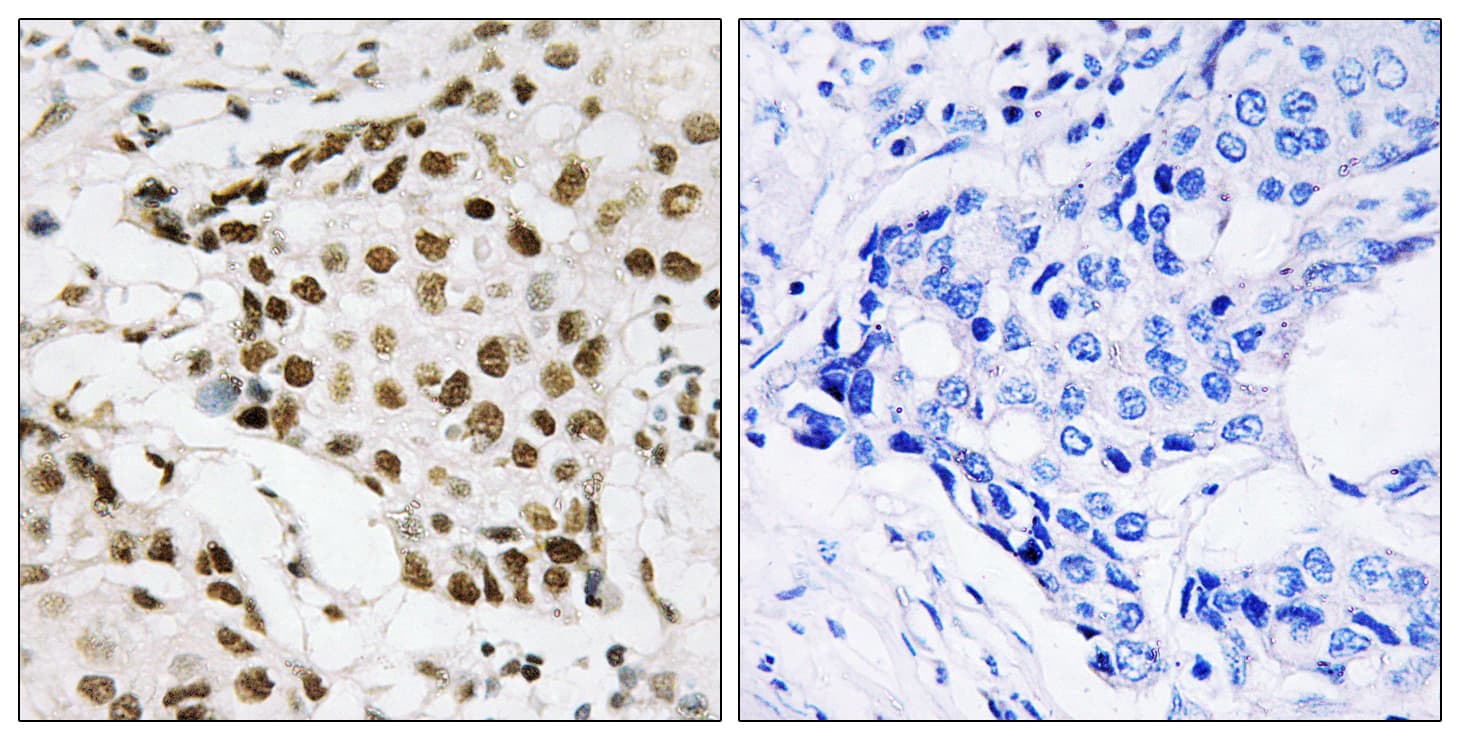 Polyclonal Rabbit anti-Human NPM1 / NPM / Nucleophosmin Antibody (phospho-Thr199, IHC, IF, WB)