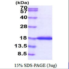 Human IFNA2 / Interferon Alpha 2 Protein (Recombinant)