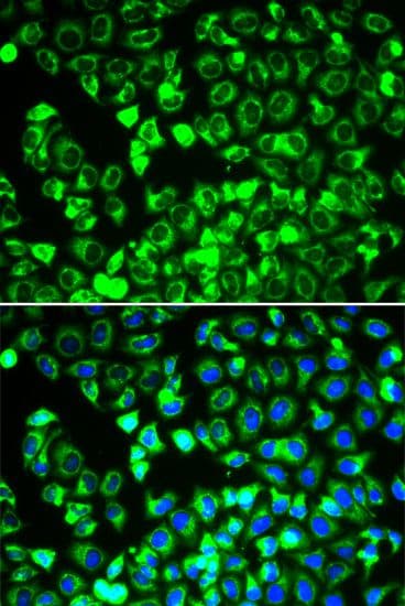 DLD / Diaphorase / E3 Antibody