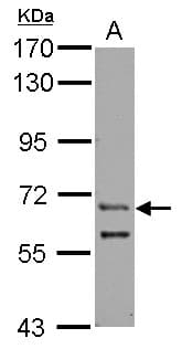 ZFY Antibody