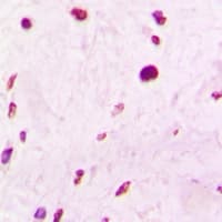 Polyclonal Rabbit anti-Human PELP1 Antibody (IHC, WB)