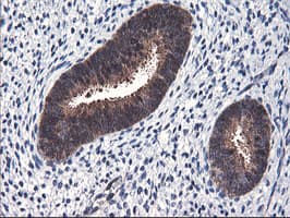 FBXO21 Antibody (clone OTI1E1)