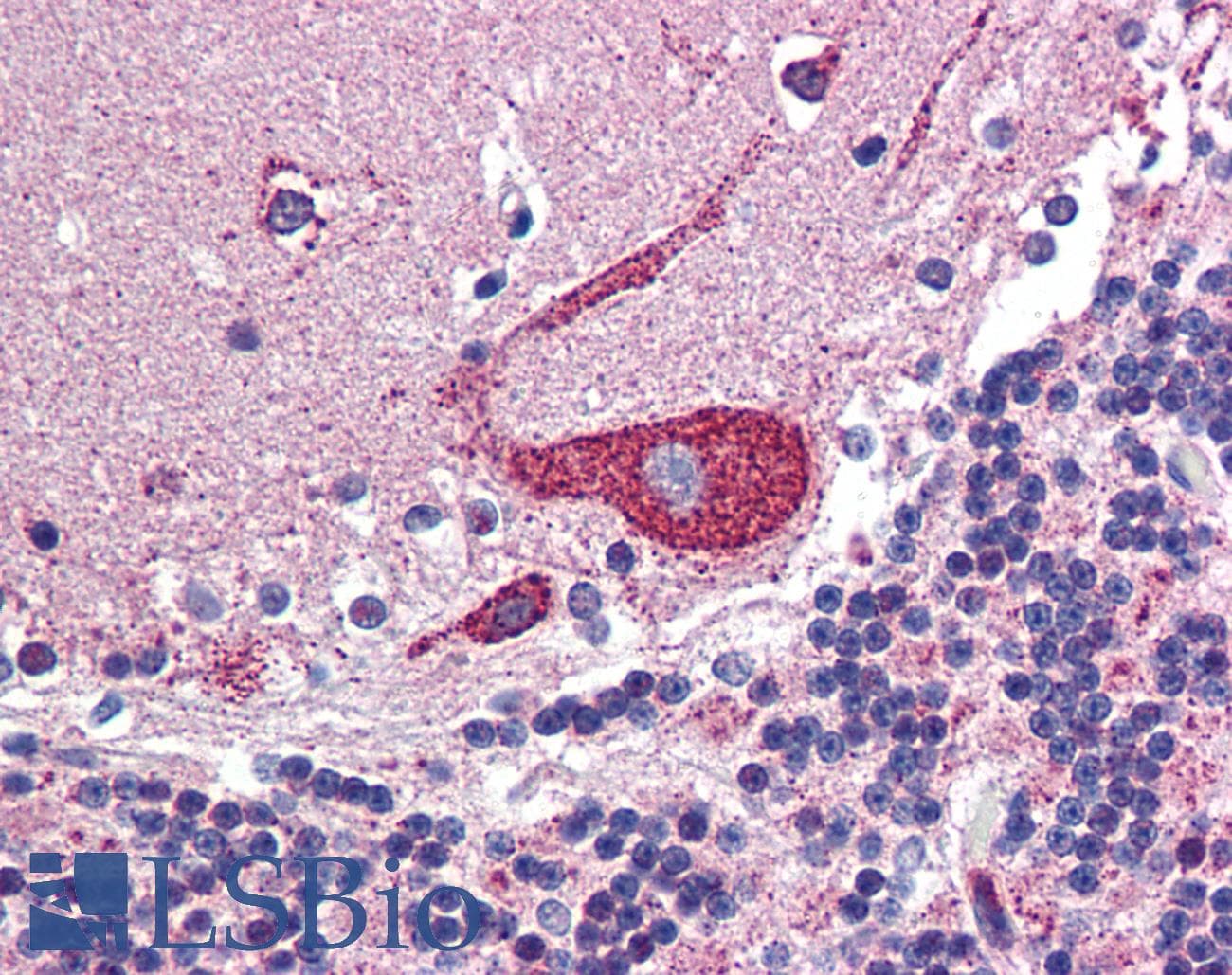 ARF6 Antibody (C-Terminus)