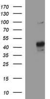 MMP13 Antibody (aa104-471, clone OTI2A6)