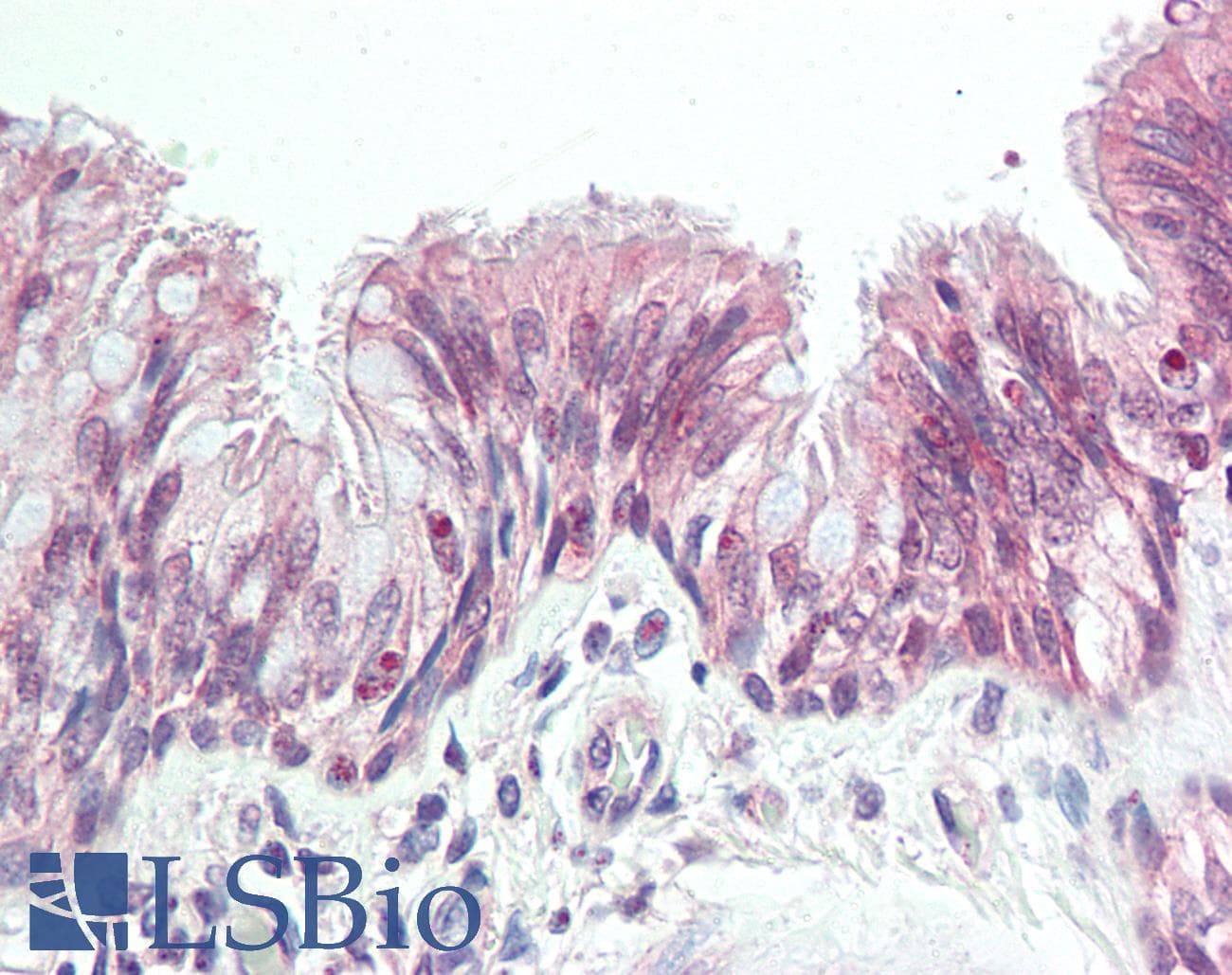IHC-plus™ ALPK1 Antibody (aa11-60)