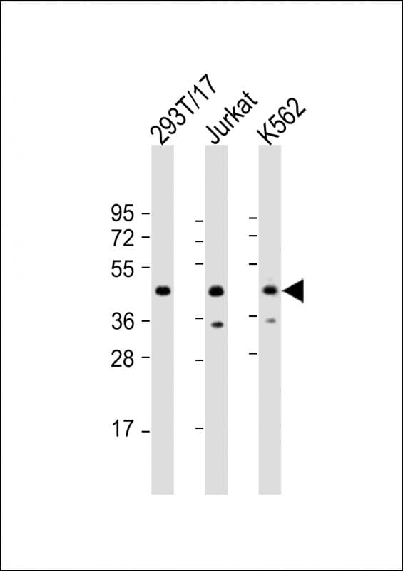 PHF6 Antibody (aa148-180)