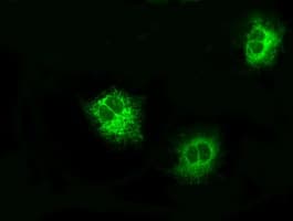 LOX / Lysyl Oxidase Antibody (clone OTI6B7)