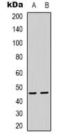 Polyclonal Rabbit anti-Human PSMD11 Antibody (Internal, IHC, WB)