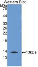 MTNR1A / Melatonin Receptor 1a Antibody (Biotin)