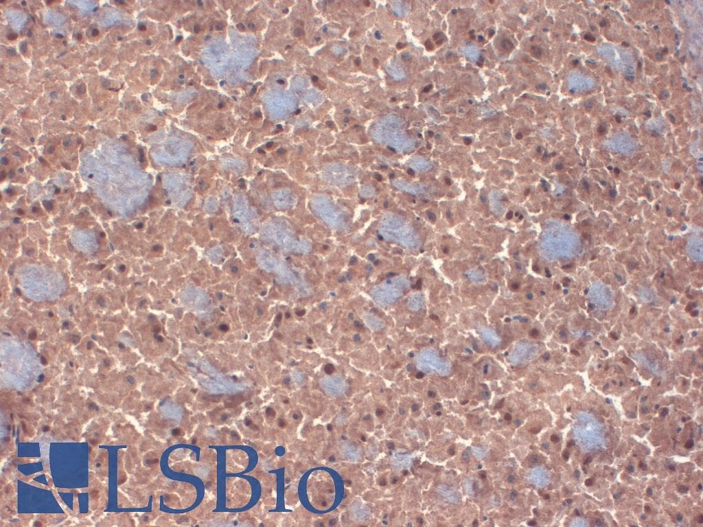 IHC-plus™ GABRB3 Antibody (clone S87-25)