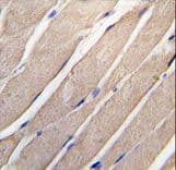 MAP2K4 / MKK4 Antibody (Ser257)