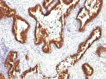 Cytokeratin 1+8 Antibody (clone KRT18/1190)