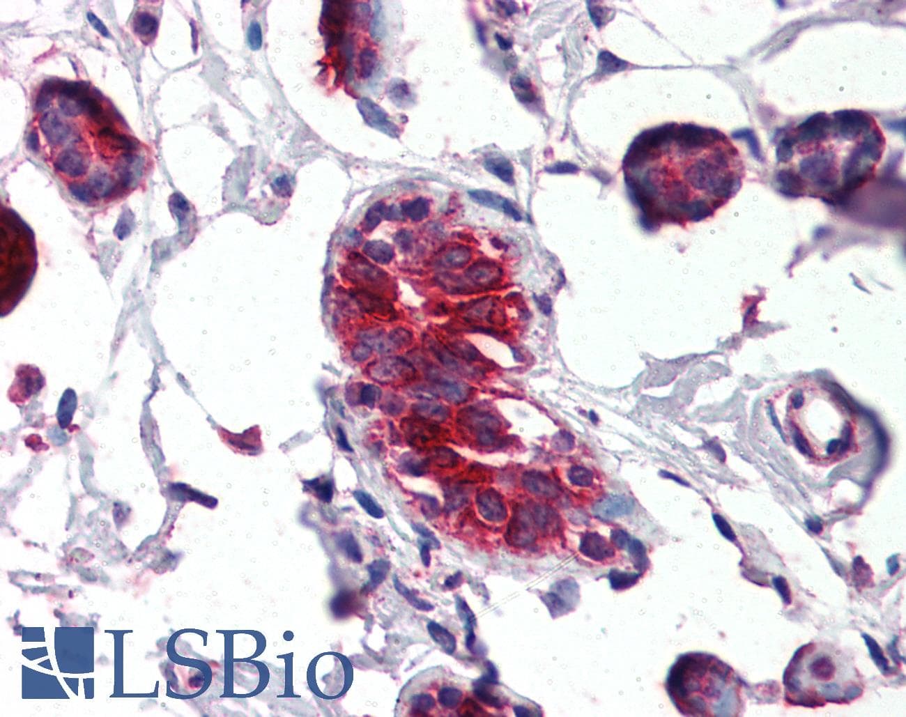 IHC-plus™ SCGB2A2 / Mammaglobin A Antibody (aa34-45)