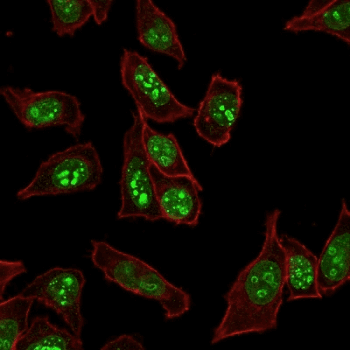 MKI67 / Ki67 Antibody (clone MKI67/2465)